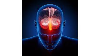 Laut einer Studie gibt es bei Projektmanagern ein deutlich höheres Risiko an Burnout zu erkranken als bei anderen Berufsgruppen. (JohanSwanepoel - Fotolia)