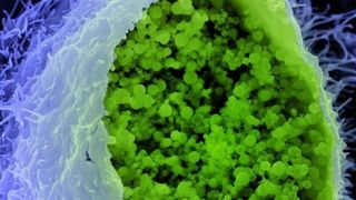 Eine Chlamydien-Infektion (in der Mikroskopaufnahme grün) begünstigt Prozesse der Krebsentstehung. (Bild: MPI für Infektionsbiologie/V. Brinkmann)