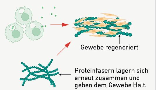 Teil 5: Die Regeneration der Wunde wird durch die nun beruhigten Immunzellen beschleunigt. Nach dem Lichtimpuls erneuert sich das Fasernetz und dient als Gerüst für das heilende Gewebe. (Bild: Fig. 1 (verändert) / Xuan Q et al. / CC BY 4.0 / nature.com)