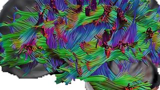 Mit der Diffusions-Tensor-Bildgebung können die ForscherInnen die Nervenfasern im Gehirn sichtbar machen. (Ausschnitt) ( © RUB, Erhan Genç )