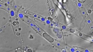 Abb. 1: Mikroskopische Aufnahme des Myzel-bildenden Boden Mikroorganimus Pythium ultimum welcher Phenanthren in seinem Zellinnern transportiert: Overlay eines Durchlicht- und Fluoreszenzbildes von Pythium ultimum, dessen Hyphen Phenanthren-angereicherte Vesikel (in blau) enthalten. (Bild: Susan Foß/UFZ)
