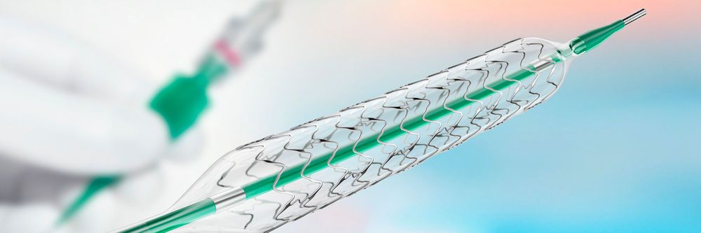 Medikamente Freisetzende Stents Ermöglichen Unter Umständen Frühes Absetzen Von Ass – News - ufx34sm