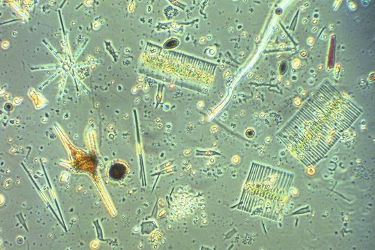 Blick durchs Mikroskop auf die vielfältige Mikroalgengemeinschaft eines Sees – zu sehen sind verschiedene Kieselalgen (Diatomeen), Grünalgen und Panzergeißeltierchen (Dinoflagellaten). Blick durchs Mikroskop auf die vielfältige Mikroalgengemeinschaft eines Sees – zu sehen sind verschiedene Kieselalgen (Diatomeen), Grünalgen und Panzergeißeltierchen (Dinoflagellaten).