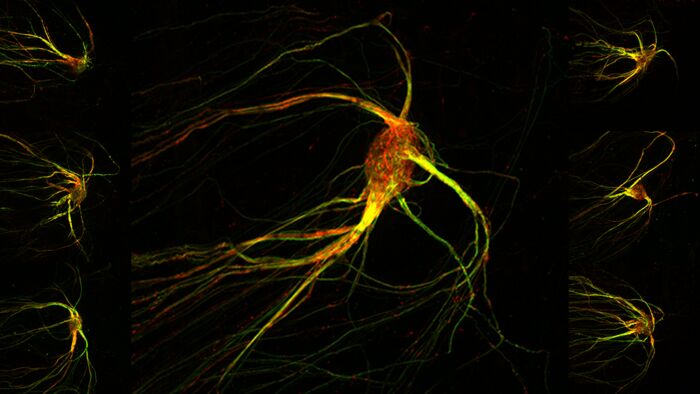Die neuronale Geruchskarte  Die Tentakel-ähnlichen Gebilde in dem Bild oben sind mikroskopische Porträts von Gehirnzellen, die Gerüche wahrnehmen. Die roten und grünen Streifen zeigen Zellen im Riechzentrum eines Mäusegehirns: dem Riechkolben. Er ist in Hunderten bis Tausenden einzelnen Clustern organisiert, den so genannten Glomeruli. Jeder Glomerulus reagiert auf spezifische Weise auf die zahllosen Duftstoffe in der Luft. Das Bild oben zeigt einen einzelnen Glomerulus, in dem die signalübertragenden Axone von den Sinneszellen in der Nase zusammenlaufen.   Hier gehts zur Originalmeldung Wissenschaftsbild des Tages vom 4.10.2022 (Hani Shayya/Stavros Lomvardas/Columbia’s Zuckerman Institute)