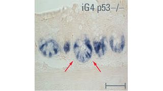 Immunhistochemische Färbung zur Identifizierung der intestinalen Stammzellen: Im alternden Gewebe mit intakten p53 werden die Stammzellen deletiert. (Bild: Leica)