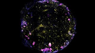 Image of the lung-on-chip, with cell nuclei in blue, macrophage in magenta, endothelial cells in yellow and tight junctions between epithelial and endothelial cells in white. (Source: Jakson Luk, Science Advances)