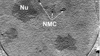 Der 3-D-Schnitt durch den Kern einer Adenokarzinom-Zelle einer Maus zeigt den Nukleolus (NU) und die quer durch den Kern verlaufenden Membrankanäle (NMC) mittels Röntgen-Nanotomographie.  (Bild: HZB/Schneider)