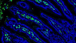 Dünndarmschleimhaut von keimfreien Mäusen mit IgA-produzierenden Plasmazellen (grün).   (Brigham & Women’s Hospital, Harvard Medical School )