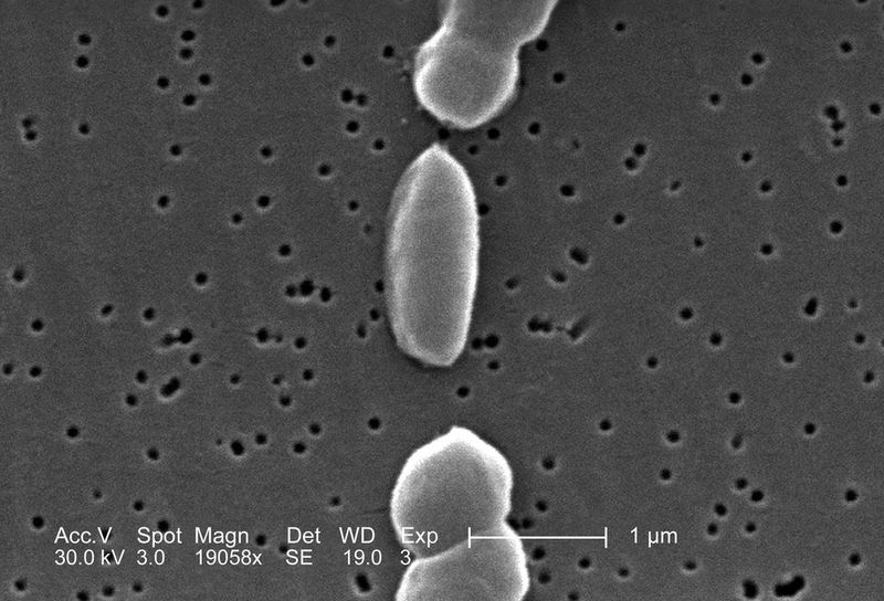Abb. 2: Der humanpathogene Erreger Vibrio parahaemolyticus kann beim Menschen Gastroenteritis auslösen und für Risikopatienten tödlich sein.  (Bild: CDC, Janice Carr)