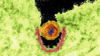 TEM-Aufnahme eines porz. endog Retrovirus (PERV). grün: Zytoplasma der infizierten Zelle; pink: sog. Clathrin-ummantelte Vertiefung; gelb: Viruspartikel; rot: Viruskern; blau: Erbsubstanz des Virus (Bild: Dr. Klaus Boller, Paul-Ehrlich-lnstitut)