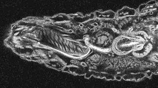 Kopf einer Fruchtfliegenlarve: Die verschiedenen inneren Strukturen der Larve (zum Beispiel Darm, Gehirn, Muskeln) sind hell hervorgehoben. (Prof. Dr. Andreas Thum)