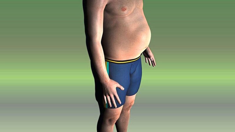 Wo sich Fett im Körper anlagert und wie stark man von einer Lebensstil-Intervention profitiert, hängt unter anderem von der Insulin-Sensitivität des Gehirns ab. (Symbolbild)