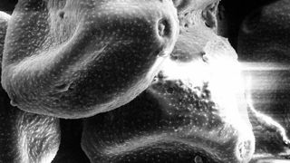 Elektronenmikroskopische Aufnahme von Haselpollen: Haselpollen lösen oft schon im Februar Allergien aus, da die Pflanze früh im Jahr blüht (Ausschnitt). (Bild: Antje Sorowka, Max-Planck-Institut für Chemie)