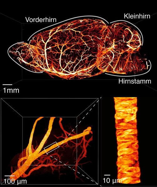 Gehirn einer Maus in Seitenansicht (links) sowie Detailaufnahmen eines Blutgefäßes (rechts) sichtbar gemacht mit dem neuartigen Lichtblatt-Fluoreszenzmikroskop. Bei dieser Aufnahmetechnik werden Strukturen mit speziellen (fluoreszierenden) Molekülen zum Leuchten gebracht. (Bild: Adaptiert nach Aakhte, M. et al., Nature Biotechnology, DOI: 10.1038/s41587-025-02882-8; lizensiert nach CC BY 4.0)