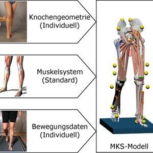Das MKS-Modell berücksichtigt drei Einflussgrößen: Knochengeometrie, Muskelsystem und Bewegungsdaten.