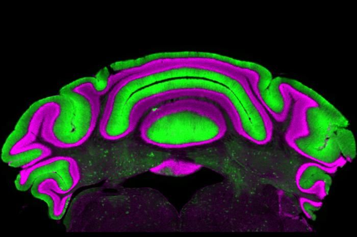 Hirnaktivität bei Bewegungsstörungen  Eine Studie der Virginia-Tech-Neurowissenschaftlerin Meike van der Heijden vom Fralin Biomedical Research Institute stellt eine weit verbreitete Annahme in der Erforschung neurologischer Bewegungsstörungen infrage. Oft konzentrieren sich Neurowissenschaftler auf die Aktivität zweier Zelltypen: Purkinje-Zellen im Kleinhirn und Zellen in den tiefen Kleinhirnkernen. Bisher gingen Forschende davon aus, dass die Aktivität der Purkinje-Zellen zuverlässig Rückschlüsse auf die Aktivität der tiefer liegenden Kernzellen erlaubt – da Purkinje-Zellen deren Aktivität hemmen.  Van der Heijdens Studie widerlegt diese Annahme. „Wir sehen, dass es keine klare lineare Beziehung zwischen der Aktivität der Purkinje-Zellen und der der tiefen Kernzellen gibt. Die Vorhersagekraft der einen für die andere ist daher sehr begrenzt“, sagt die Neurowissenschaftlerin.  Das Bild zeigt: Purkinje-Zellen im Kleinhirn (grün) und Zellen der tiefen Kleinhirnkerne (dunkle Bereiche mit grünen Einsprengseln in der Bildmitte).   Hier geht‘s zur Originalmeldung Wissenschaftsbild des Tages vom 2.7.2026  (Bild: Meike van der Heijden/Virginia Tech)