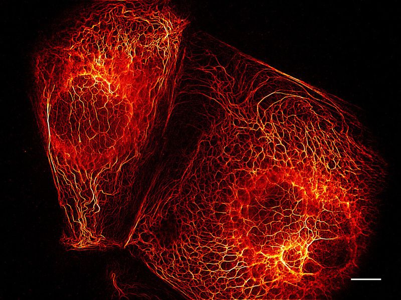 Parallelisierte RESOLFT-Nanoskopie erlaubt sekundenschnelles Abbilden lebender Zellen. Das Bild zeigt das Stützprotein Keratin in Krebszellen. Es basiert auf 144 Einzelaufnahmen, die gesamte Aufnahmedauer liegt in der Größenordnung einer Sekunde. Maßstab: 10 µm. (Andriy Chmyrov, Stefan W. Hell, Max-Planck-Institut für biophysikalische Chemie)