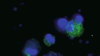 Abb. 1: Dendritische Zellen von der Katze; Doppelfärbung (DAPI und mouse anti-cat MHC II/goat-anti-mouse-FITC) zur Quantifizierung MHC-II-positiver Zellen (Bild: PetBioCell GmbH, L. Zeh)