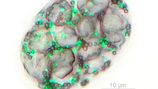 Zelle des Bakteriums Achromatium oxaliferum unter dem Mikroskop. Man erkennt große Calciumkristalle, Schwefeltröpfchen sowie grün fluoreszierende DNA-Spots. (Heribert Cypionka / Universität Oldenburg)