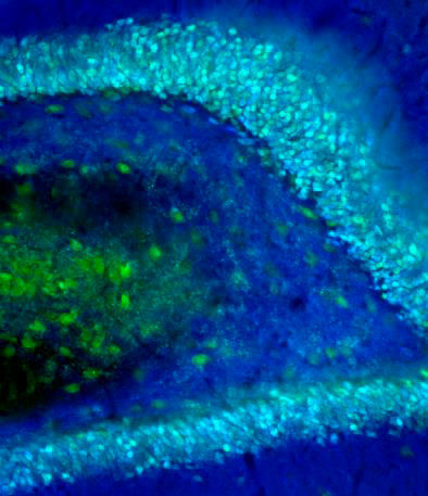 Körnerzellen im Gyrus dentatus einer Ratte, durch Fluoreszenzmikroskopie sichtbar gemacht (in Cyanblau). (Abbildung: (c) Burgalossi Lab)
