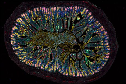 This tissue section, taken from the intestine of a mouse unable to produce the neuropeptide VIP, clearly shows the striking frequency with which certain cell types occur on the intestine's surface. These include villous cells (red), mucus-producing goblet cells (yellow), Paneth cells (pink) and stem cells (green). (Source:  © Charité | Luisa Barleben)