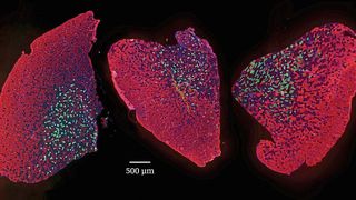 Die Muskelgrösse nimmt im Alter ab, bleibt mit Rapamycin aber erhalten (von links: Muskelquerschnitt von junger, alter und mit Rapamycin-behandelter alter Maus). (Universität Basel, Biozentrum)