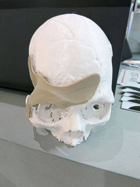 Nicht dabei hat Apium den medizinischen PEEK-Drucker Apium M220, mit dem patientenspezifische Implantate individuell angefertigt werden können. Denn derzeit befindet sich das System noch in der Validierungsphase. (Bild: Schäfer / Devicemed)