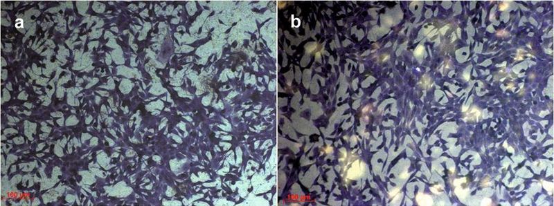 Bild 5:	Lichtmikroskopische Aufnahme von vitalen Maus-Zellen auf einer Silber-Plasmapolymer-Beschichtung (a) und auf der Plasmapolymer-Beschichtung (b).  (Bild: Bio-Gate)