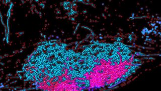 Gehirnstammkern, der Informationen von Interneuronen aus dem Rückenmark sammelt (blau); Informationen einer funktionellen Interneuronen-Subgruppe fliesst in einem Teilareal zusammen (pink). (Bild: Universität Basel, Biozentrum)