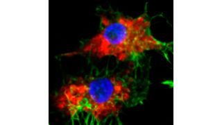 A microscopy image that shows SNAs (in red) taken up into leukemia cells. Cell nuclei shown in blue.
 (Source: Mirkin Research Group/ Northwestern University)