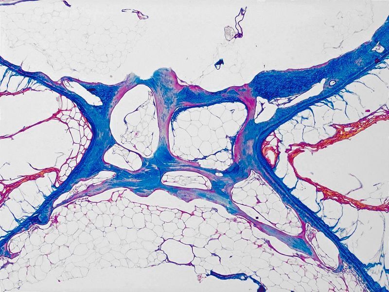 Mikroskopische Aufnahme eines histologischen Schnitts durch den Wirbel eines reifen Aals. Die Hohlräume zeigen deutlich den Abbau der Knochenstruktur.  (© Freese et al.)