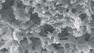 REM-Nahansicht: In der porösen Trägerstruktur der Membranadsorber sind winzige Polymerpartikel eingebettet, die Schadstoffe aus dem Wasser binden. (Bild: Fraunhofer IGB)