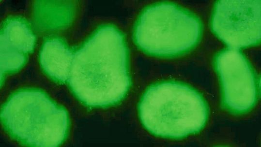 Ein Aspergillus nidulans-Reporterstamm, der grün fluoreszierendes Protein (GFP) produziert. Ein Aspergillus nidulans-Reporterstamm, der grün fluoreszierendes Protein (GFP) produziert.