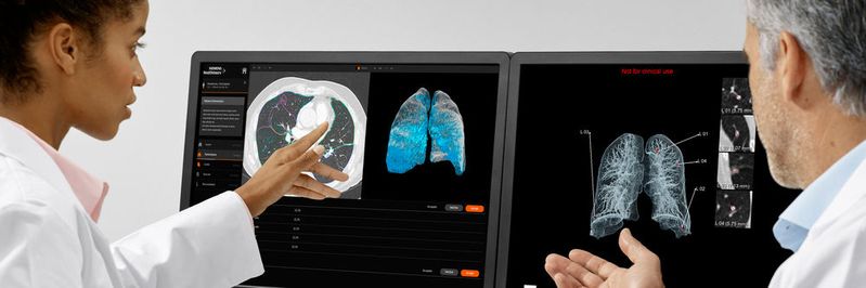 AI-Rad Companion Chest CT ist eine auf künstlicher Intelligenz (KI) basierende Software für die Computertomografie (CT). Die zugrundeliegenden Algorithmen wurden in Wissenschaftsteams bei Siemens Healthineers anhand von umfangreichen klinischen Datensätzen trainiert.(Bild:  Siemens Healthineers)