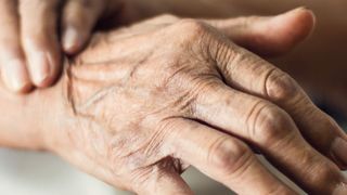 Bei der Parkinson-Erkrankung verbreiten sich anormale Proteine im Gehirn. Oxidativer Stress könnte dafür eine treibende Kraft sein.  (©ipopba - stock.adobe.com)