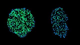 Links Beta-Zellen eines erwachsenen Tiere (grün gefärbt), rechts die eines heranwachsenden Tieres nach langfristigem Intervallfasten (Bild: Leonardo Matta / TUM)