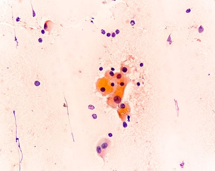 10 neue Medikamente für immunologische Erkrankungen (Bild: Saiful52 - stock.adobe.com)