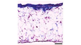 Abb. 1: Einlagerung von Collagen durch MSCs von Ratten, die sich in einer 3D-Zellkultur unter Verwendung von Alvetex-Scaffold zu Knochenzellen ausdifferenziert haben. Massons Trichrom-Färbung einer extrazellulären Collagenmatrix. Beachten Sie die Einlagerung bedeutender Mengen von Collagen in den oberen Schichten des Gerüstes. Maßstabsleiste: 40 µm (Bild: Fisher Scientific)