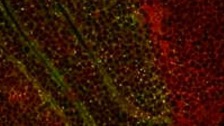 Co-Rezeptoren (rot) befinden sich auf den Zell-Oberflächen. Pentagone (grün) bewirkt, dass die Co-Rezeptoren von der Zelle aufgenommen und in ihrem Inneren abgebaut werden (gelb/grün). (AG Pyrowolakis)