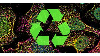 Endosomi di smistamento (verdi) e vescicole di riciclaggio (magenta) nelle cellule umane. (Immagine:Biozentrum, Università di Basilea)