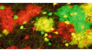Astrozyten im Gehirn von Mäusen, markiert mit der MADM-Technik (Bild: Simon Hippenmeyer / IST Austria)