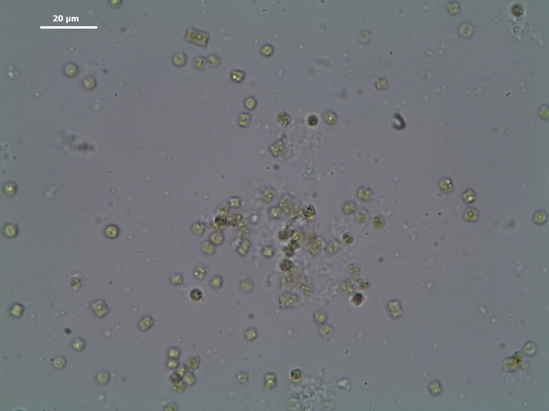 Abb.8: Zellen der Mikroalge Thalassiosira pseudonana vor dem Aufschluss (Bild: Retsch)