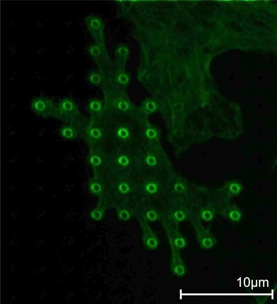 3b Immunozytochemische Färbung der Aktin-Filamente in Kardiomyozyten auf einem Nail-Array mit 3-µm-Pitch. (Archiv: Vogel Business Media)