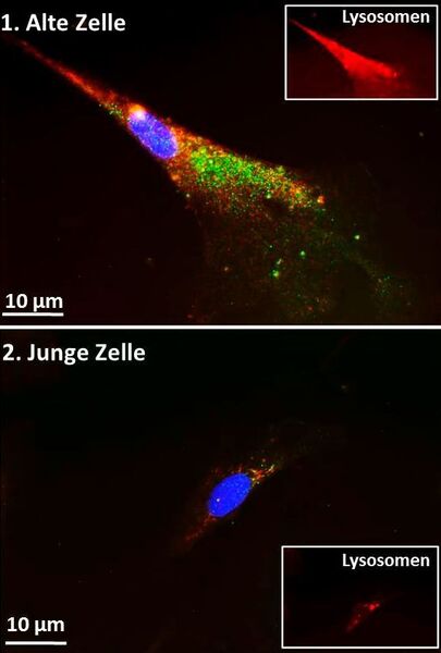 Mit Fluoreszenzfarbstoffen markierte Bindegewebszellen; Rot = Lysosomen, Grün = Ferritin, Blau = Zellkern (© DIfE)