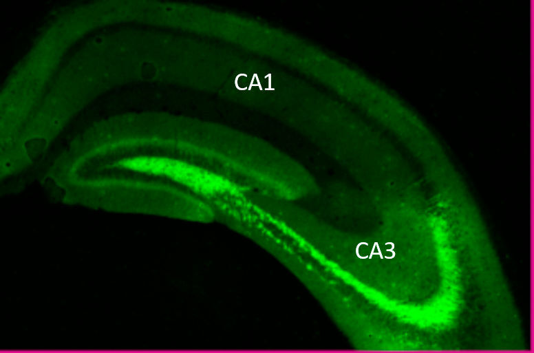 Fluoreszenzmikroskopie eines Mäusehirns: Für das episodische Gedächtnis sind vor allem die Unterregionen CA1 und CA3 mit ihren Neuronen-Ensembles im Hippocampus entscheidend. (LIN/Erika Atucha Trevino)