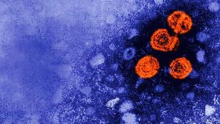 Hepatitis-B-Viruspartikel orange angefärbt; elektronenmikroskopische Aufnahme. (CDC/Dr. Erskine Palmer)