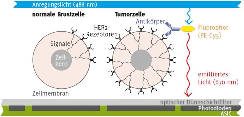 Nachweis des verstärkten Auftretens von HER2-Proteinen an Brustkrebszellen mithilfe von Fluoreszenzmarkern (in diesem Fall PE-Cy5).