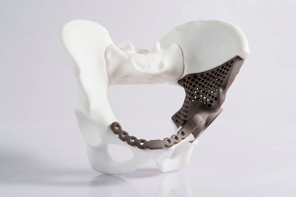 Ein Hüftimplantat aus einem 3D-Drucker (EOS GmbH)