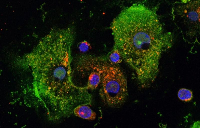 Zellnetzwerk heilt Darm  Ein Team der Universität Bonn und des Forschungszentrums Borstel, Leibniz Lungenzentrum (FZB) hat einen bislang unbekannten Wirkmechanismus eines synthetischen Peptids entdeckt, der die überschießende Entzündungsreaktionen bei allergischem Asthma abschwächt. Dabei wird ein zentraler Entzündungsschalter des Immunsystems gezielt gehemmt und eröffnet neue Ansatzpunkte zur Behandlung chronischer Entzündungserkrankungen. Das Bild zeigt humane Makrophagen mit immunregulierendem Peptid Pep19-2.5 (grün) und Färbung der „dispersed Transgolgi Netzwerk Membran“ (rot).   Hier geht‘s zur Originalmeldung Wissenschaftsbild des Tages vom 20.8.2026  (Bild: A. Schromm/FZB)