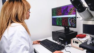 Durch den Einsatz von fluoreszierenden Farbstoffen lassen sich die Partikel in den Zellen sichtbar machen und der Weg des Virus genau verfolgen. (Roberto Schirdewahn)